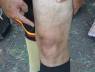 RODILLA