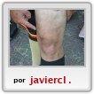 RODILLA